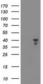 MSI1 Antibody in Western Blot (WB)