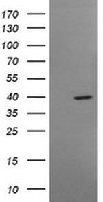 MSI1 Antibody in Western Blot (WB)