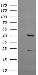 MSI1 Antibody in Western Blot (WB)