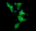 MSI2 Antibody in Immunocytochemistry (ICC/IF)