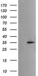 MSI2 Antibody in Western Blot (WB)