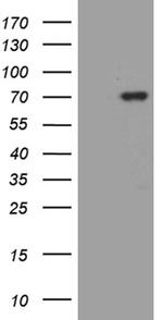 MSL2 Antibody in Western Blot (WB)