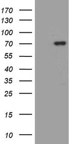MSL2 Antibody in Western Blot (WB)