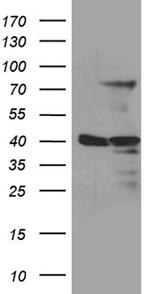 MSL2 Antibody in Western Blot (WB)
