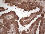 MSLN Antibody in Immunohistochemistry (Paraffin) (IHC (P))