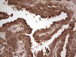 MSLN Antibody in Immunohistochemistry (Paraffin) (IHC (P))