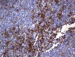 MSLN Antibody in Immunohistochemistry (Paraffin) (IHC (P))