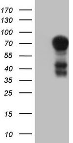 MSLN Antibody in Western Blot (WB)
