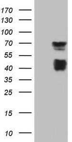 MSLN Antibody in Western Blot (WB)