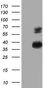 MSLN Antibody in Western Blot (WB)