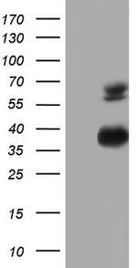 MSLN Antibody in Western Blot (WB)