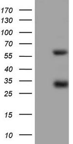 MSLN Antibody in Western Blot (WB)