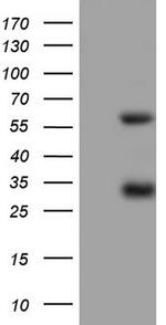 MSLN Antibody in Western Blot (WB)