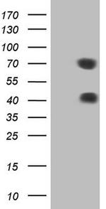 MSLN Antibody in Western Blot (WB)
