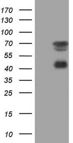 MSLN Antibody in Western Blot (WB)