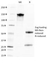 Cytomegalovirus p65 (CMV-p65) Monoclonal Antibody (CMV100)