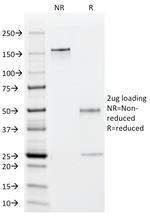 EBV Early Antigens (Epstein Barr Virus) Monoclonal Antibody (1108-1)