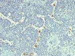 HPV-18 (Human Papilloma Virus 18) Antibody in Immunohistochemistry (Paraffin) (IHC (P))