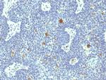 HPV-18 (Human Papilloma Virus 18) Monoclonal Antibody (HPV18/1297)