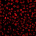 IgG1 Isotype Control for Mouse Monoclonal Antibody (ICG1/1331)