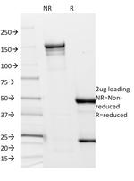 Borrelia burgdorferi (p41 Flagellin) Monoclonal Antibody (6802)
