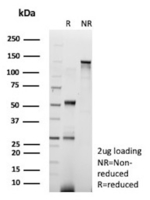 DNA-RNA Hybrid Antibody in SDS-PAGE (SDS-PAGE)
