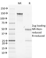 MHC II Monoclonal Antibody (MK-D6)
