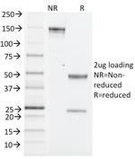 NK1.1/CD161c/Klrb1c Antibody in SDS-PAGE (SDS-PAGE)