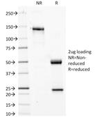 Phosphotyrosine (P-Tyr) Antibody in SDS-PAGE (SDS-PAGE)