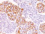 Phosphotyrosine (P-Tyr) Antibody in Immunohistochemistry (Paraffin) (IHC (P))