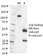 Pseudomonas aeruginosa serotype 6C Monoclonal Antibody (1200/472)