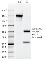 Testosterone Antibody in SDS-PAGE (SDS-PAGE)