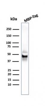 Maltose Binding Protein/MBP-probe Monoclonal Antibody (R29.6)