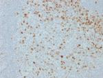Proliferation Marker Antibody in Immunohistochemistry (Paraffin) (IHC (P))