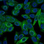 Cytokeratin, Multi (Epithelial Marker) Monoclonal Antibody (C11)