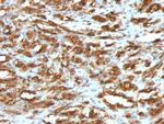 Actin, Muscle Specific (Muscle Cell Marker) Monoclonal Antibody (HHF35)