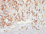Plasma Cell Marker Monoclonal Antibody (LIV3G11 (7B18))