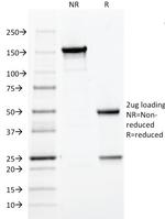 HPV-16 (Human Papilloma Virus 16) Antibody in SDS-PAGE (SDS-PAGE)