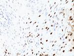 HPV-16 (Human Papilloma Virus 16) Antibody in Immunohistochemistry (Paraffin) (IHC (P))