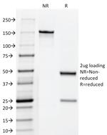 HCG Holo (Pregnancy and Choriocarcinoma Marker) Antibody in SDS-PAGE (SDS-PAGE)