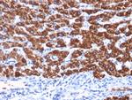Hepatocyte Specific Antigen (Hepatocellular Marker) Monoclonal Antibody (OCH1E5)