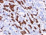 Hepatocyte Specific Antigen (Hepatocellular Marker) Antibody in Immunohistochemistry (Paraffin) (IHC (P))