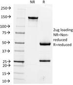 Hepatocyte Specific Antigen (Hepatocellular Marker) Antibody in SDS-PAGE (SDS-PAGE)