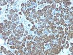 Mitochondria (Marker for Human Cells, Granular RCC s and Salivary Tumor Antibody in Immunohistochemistry (Paraffin) (IHC (P))