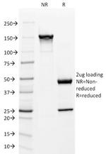 Mitochondria (Marker for Human Cells, Granular RCC s and Salivary Tumor Antibody in SDS-PAGE (SDS-PAGE)