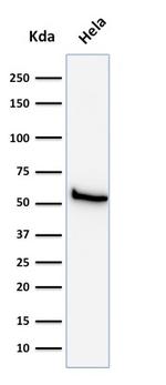 Mitochondria (Marker for Human Cells, Granular RCC s and Salivary Tumor Antibody in Western Blot (WB)
