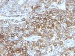 PNL2 (Melanoma Associated Antigen) Antibody in Immunohistochemistry (Paraffin) (IHC (P))