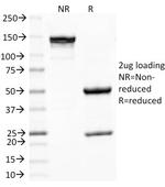 PNL2 (Melanoma Associated Antigen) Antibody in SDS-PAGE (SDS-PAGE)