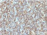 Double Stranded DNA (dsDNA) (Nuclear Marker) Antibody in Immunohistochemistry (Paraffin) (IHC (P))