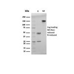 Double Stranded DNA (dsDNA) (Nuclear Marker) Antibody in SDS-PAGE (SDS-PAGE)